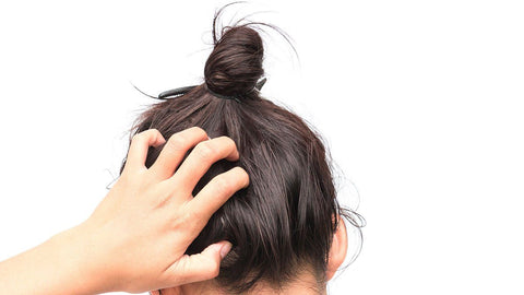 THE SECRET CAUSE BEHIND YOUR ITCHY SCALP IS THIS